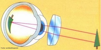 Lente que apresenta a parte central mais larga que as bordas. Atua na convergncia dos raios luminosos antes de chegarem ao olho, permitindo a criao do ponto focal na retina. Utilizada na correo da hipermetropia, dificuldade de enxergar de perto.
<br /><br />
Palavras-chave: tica, lentes, convexas, convergentes, luz, retina, viso, correo, hipermetropia.
