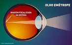 Estado normal do poder de refração do olho, onde a imagem de um objeto forma-se sobre a retina. <br /><br /> Palavras-chave: Ótica, refração, visão, normal, retina, cristalino, imagem, objeto.