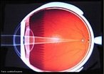 Na miopia o globo ocular  mais alongado que o normal. A imagem se forma antes da retina. O mope tem dificuldade para enxergar de longe. Esta imperfeio  compensada atravs do uso de lentes cncavas, que permitem divergir ligeiramente os raios luminosos antes de chegarem  crnea, possibilitando a formao do ponto focal na retina. <br /><br /> Palavras-chave: tica, lentes, divergentes, viso, imperfeio, miopia, retina, imagem.