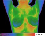 Corresponde ao registro das variaes da temperatura corporal em imagem colorida. A partir da radiao trmica emitida pelo movimento normal das molculas que compem os materiais. Geralmente quanto mais quente a rea lida, mais a cor tende ao vermelho. Mtodo imagiolgico utilizado para diagnstico em Medicina. <br /><br /> Palavras-chave:   Temperatura, radiao, imagem, mtodo, molculas, medicina.  